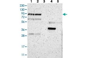 Western blot analysis of Lane 1: RT-4, Lane 2: U-251 MG, Lane 3: Human Plasma, Lane 4: Liver, Lane 5: Tonsil with LEPREL1 polyclonal antibody .