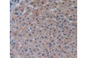 Figure. (LPCAT3 Antikörper  (AA 122-233))