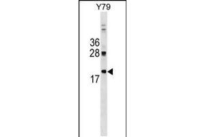 Western blot analysis in Y79 cell line lysates (35ug/lane). (DNAJC5 Antikörper  (AA 52-80))