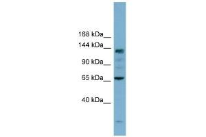IARS antibody used at 1 ug/ml to detect target protein. (IARS Antikörper  (N-Term))