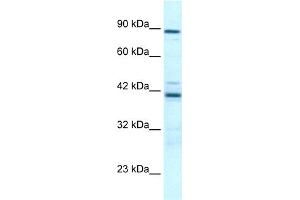 WB Suggested Anti-TBX5 Antibody Titration:  0. (T-Box 5 Antikörper  (Middle Region))