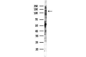anti-PTK2 Protein tyrosine Kinase 2 (PTK2) (pTyr397) antibody
