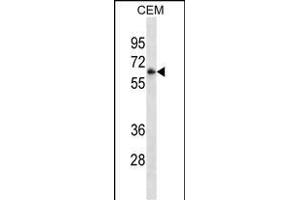 Western Blotting (WB) image for anti-Fc Fragment of IgG, Low Affinity IIIa, Receptor (CD16a) (FCGR3A) (AA 60-88) antibody (ABIN1539896)