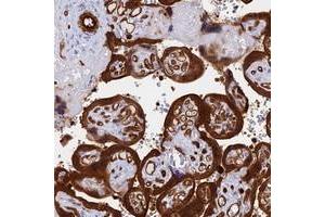 Immunohistochemical staining of human placenta with CRIP2 polyclonal antibody  shows strong cytoplasmic and membranous positivity in trophoblastic cells at 1:500-1:1000 dilution. (CRIP2 Antikörper)