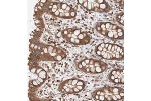 Immunohistochemical staining of human rectum with RP5-1000E10. (SIKE1 Antikörper)
