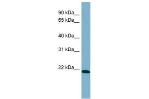 WB Suggested Anti-TIRAP Antibody Titration: 0. (TIRAP Antikörper  (Middle Region))