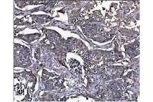 IHC analysis of ERAP2 using anti-ERAP2 antibody (ABIN7599949). (ERAP2 Antikörper  (AA 13-960))