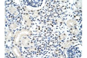 SSB antibody was used for immunohistochemistry at a concentration of 4-8 ug/ml to stain Epithelial cells of renal tubule (arrows) in Human Kidney. (SSB Antikörper)