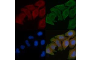ABIN6258556 and ABIN6275402 staining Hela cells by IF/ICC. (POTEB Antikörper  (C-Term))