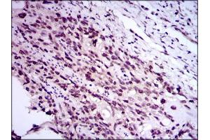 Image no. 2 for anti-E2F Transcription Factor 1 (E2F1) antibody (ABIN1491636) (E2F1 Antikörper)