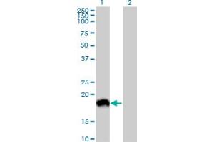 Western Blot analysis of MAP1LC3A expression in transfected 293T cell line by MAP1LC3A MaxPab polyclonal antibody. (MAP1LC3A Antikörper  (AA 1-121))