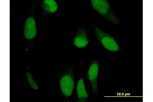 Immunofluorescence (IF) image for anti-Peripherin (PRPH) (AA 374-470) antibody (ABIN519309)