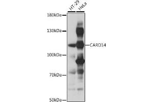 Western blot analysis of extracts of various cell lines, using C antibody (ABIN7266126) at 1:1000 dilution. (CARD14 Antikörper  (AA 200-500))