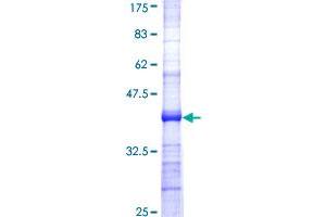 B3GALT5 Protein (AA 29-128) (GST tag)