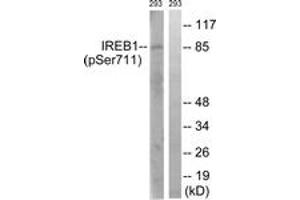 Western blot analysis of extracts from 293 cells treated with insulin 0. (Aconitase 1 Antikörper  (pSer711))