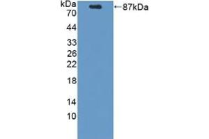 Figure. (PCSK9 Antikörper  (AA 156-694))