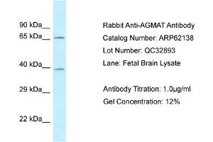 Western Blotting (WB) image for anti-Agmatine Ureohydrolase (Agmatinase) (AGMAT) (N-Term) antibody (ABIN2789033) (AGMAT Antikörper  (N-Term))