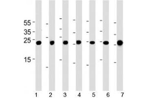 Cebpd antibody western blot analysis in 1) A549, 2) HeLa, 3) NCI-H460, 4) U-937, 5) mouse NIH3T3 cell line, rat 6) lung and 7) testis tissue lysate. (CEBPD Antikörper  (AA 161-189))