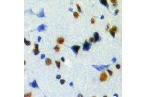 Immunohistochemical analysis of JMJD6 staining in mouse brain formalin fixed paraffin embedded tissue section. (JMJD6 Antikörper)