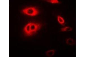 Immunofluorescent analysis of RIPK2 staining in MCF7 cells. (RIPK2 Antikörper)