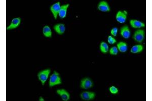 Immunofluorescence staining of Hela cells with ABIN7159009 at 1:133, counter-stained with DAPI. (MARVELD3 Antikörper  (AA 1-189))