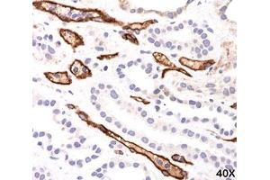 IHC testing of FFPE human kidney transplant tissue (40X) stained with Complement 4d / C4d antibody (C4D204).
