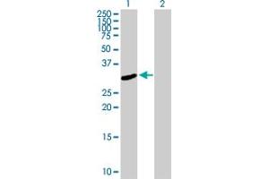 Western Blot analysis of FRMPD2 expression in transfected 293T cell line by FRMPD2 MaxPab polyclonal antibody. (FRMPD2 Antikörper  (AA 1-261))