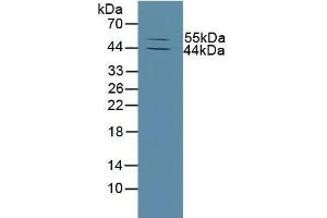 Detection of MMP13 in Mouse Skin Tissue using Polyclonal Antibody to Matrix Metalloproteinase 13 (MMP13) (MMP13 Antikörper  (AA 290-468))
