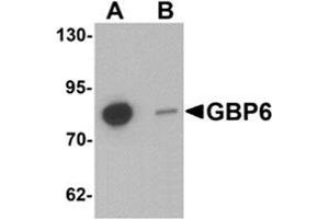 Western blot analysis of GBP6 in Hela cell lysate with GBP6 Antibody  at 0.