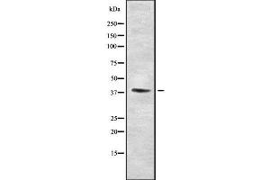 Western blot analysis SETD7 using Jurkat whole cell lysates