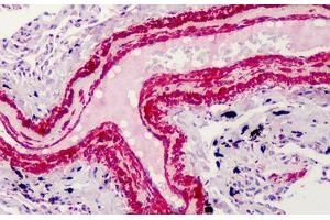 Human Smooth Muscle: Formalin-Fixed, Paraffin-Embedded (FFPE) (Smooth Muscle Actin Antikörper  (N-Term))