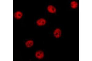 ABIN6274375 staining HT29 cells by IF/ICC. (NAB2 Antikörper  (C-Term))