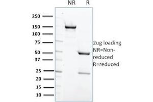 SDS-PAGE Analysis Purified PTPN6 Mouse Monoclonal Antibody (CPTC-PTPN6-2). (SHP1 Antikörper)