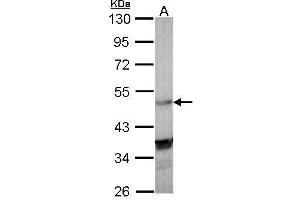 WB Image Sample (30 ug of whole cell lysate) A: Molt-4 , 10% SDS PAGE antibody diluted at 1:1000 (NR1H3 Antikörper  (C-Term))