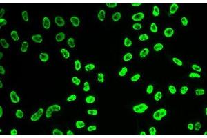 Immunofluorescence analysis of HeLa cells using SNRPA Polyclonal Antibody (SNRPA1 Antikörper)