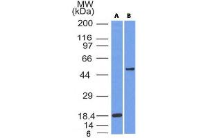 Image no. 2 for anti-SRY (Sex Determining Region Y)-Box 10 (SOX10) (AA 115-269) antibody (ABIN6181099) (SOX10 Antikörper  (AA 115-269))