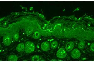 Immunohistochemistry analysis using Rabbit Anti-Ubiquitin Polyclonal Antibody . (Ubiquitin Antikörper  (PE))