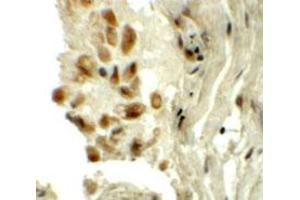 Immunohistochemical staining of human lung cells with TYW1 polyclonal antibody  at 5 ug/mL. (TYW1 Antikörper  (C-Term))