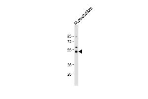 Anti-Dnmt2 Antibody  at 1:1000 dilution + mouse cerebellum lysate Lysates/proteins at 20 μg per lane. (Dnmt2 Antikörper  (AA 346-375))