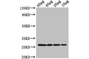 Western Blot Positive WB detected in: Rosseta bacteria lysate at 80 μg, 40 μg, 20 μg, 10 μg All lanes: rpsB antibody at 2. (rPSB (AA 2-241) Antikörper)