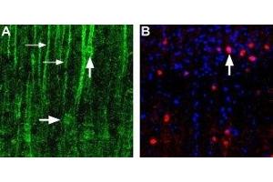 Expression of α1D-Adrenoceptor in rat neocortex - Immunohistochemical staining of α1D-adrenoceptor in rat neocortex using Anti-α1D-Adrenergic Receptor (extracellular) Antibody (ABIN7042896, ABIN7043916 and ABIN7043917). (ADRA1D Antikörper  (C240S, Extracellular))