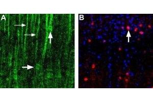 Expression of α1D-Adrenoceptor in rat neocortex - Immunohistochemical staining of α1D-adrenoceptor in rat neocortex using Anti-α1D-Adrenergic Receptor (extracellular) Antibody (ABIN7042896, ABIN7043916 and ABIN7043917). (ADRA1D Antikörper  (3rd Extracellular Loop, Cys240))