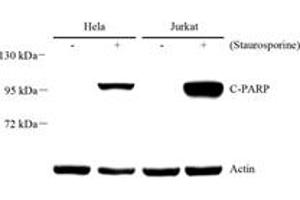 Western blot analysis of PARP1 (ABIN7075114),at dilution of 1: 1000 (PARP1 Antikörper  (cleaved))