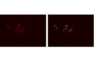 ABIN6277407 staining Hela cells by IF/ICC. (MMP10 Antikörper  (Internal Region))