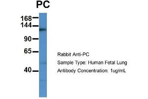 Host: Rabbit  Target Name: PC  Sample Tissue: Human Fetal Lung  Antibody Dilution: 1. (PC (C-Term) Antikörper)