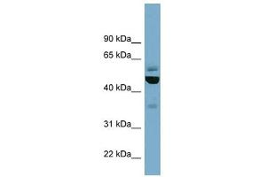 Epsilon Tubulin 1 antibody used at 1 ug/ml to detect target protein. (TUBE1 Antikörper  (Middle Region))