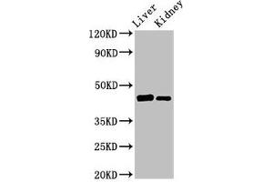 Western Blot Positive WB detected in: Rat liver tissue, Mouse kidney tissue All lanes: GALT antibody at 3 μg/mL Secondary Goat polyclonal to rabbit IgG at 1/50000 dilution Predicted band size: 44, 32 kDa Observed band size: 44 kDa (GALT Antikörper  (AA 1-379))
