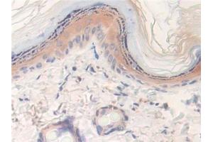 Detection of LXN in Rat Skin Tissue using Polyclonal Antibody to Latexin (LXN) (Latexin Antikörper  (AA 1-223))