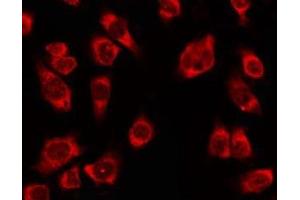 ABIN6278610 staining Hela by IF/ICC. (OR4K2 Antikörper  (C-Term))