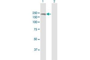 Western Blotting (WB) image for anti-Timeless Homolog (TIMELESS) (AA 1-1208) antibody (ABIN948752)
